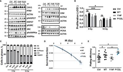 Stromal Fibroblasts Counteract the Caveolin-1-Dependent Radiation Response of LNCaP Prostate Carcinoma Cells